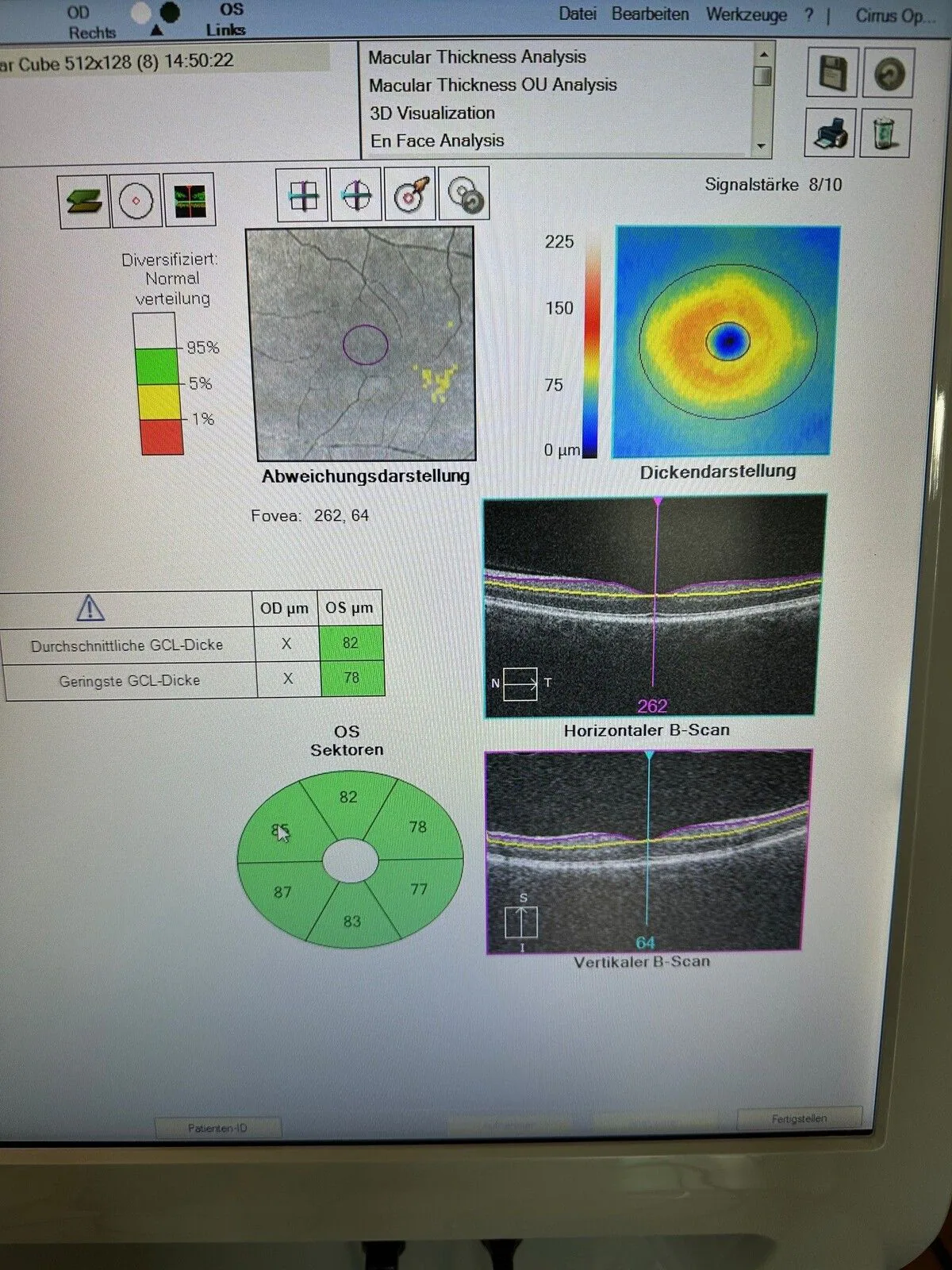 خرید OCT Zeiss CIRRUS 500