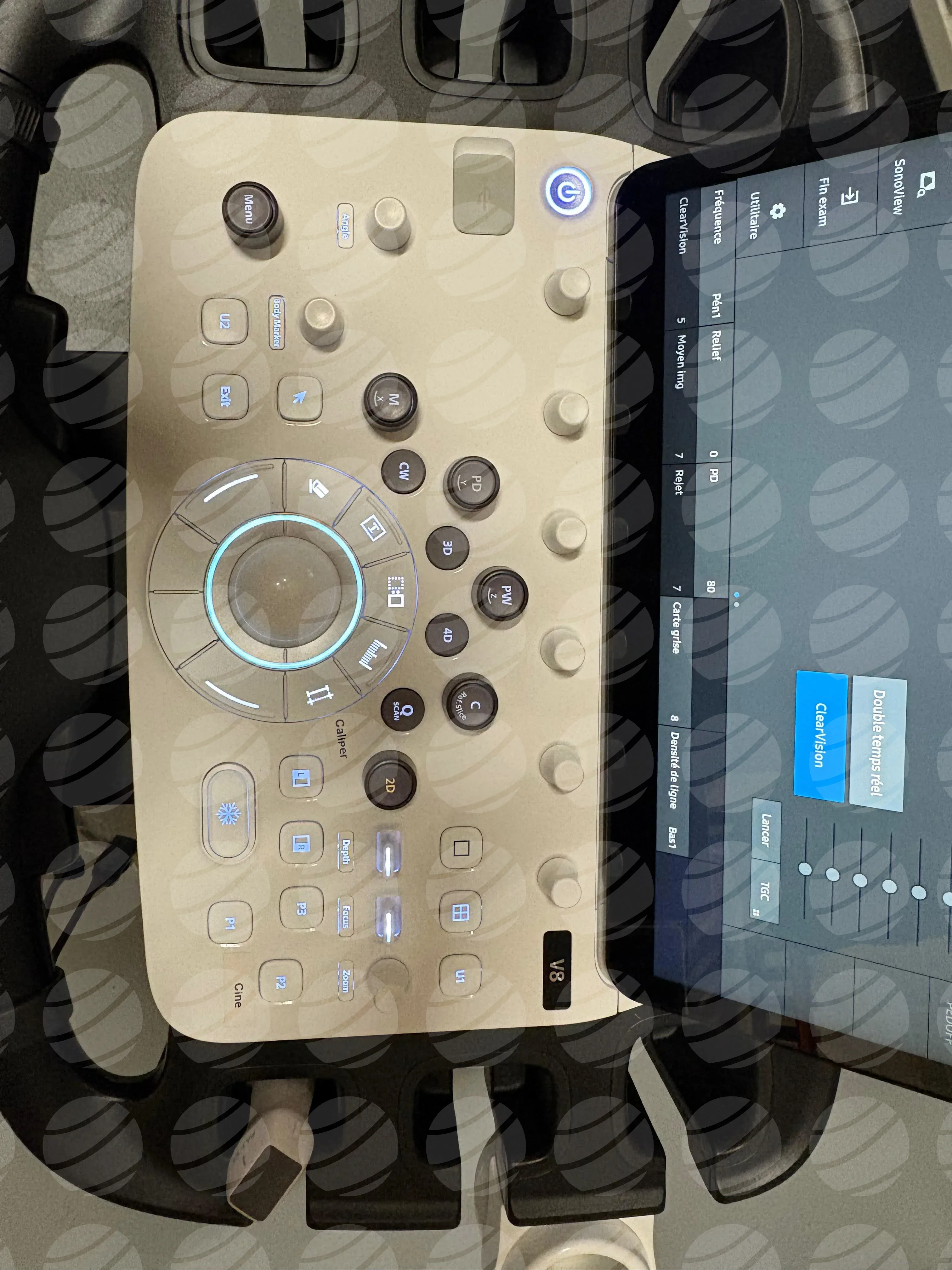 سونوگرافی سامسونگ Samsung V8