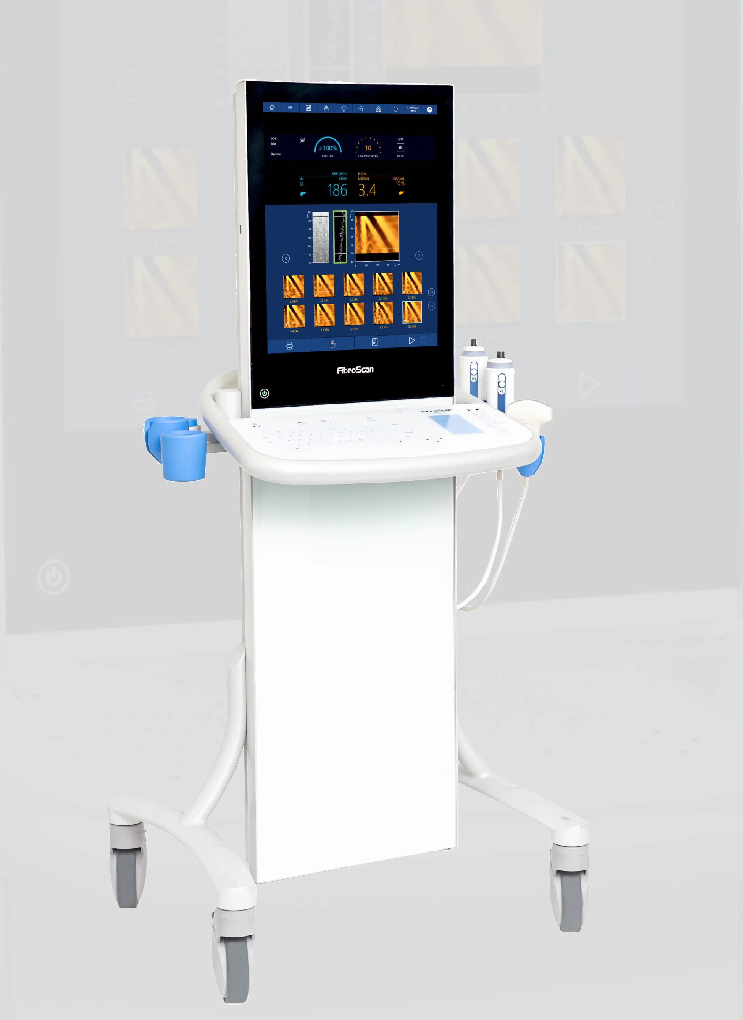 دستگاه فیبرواسکن ۶۳۰ اکسپرت - Fibroscan 630 expert