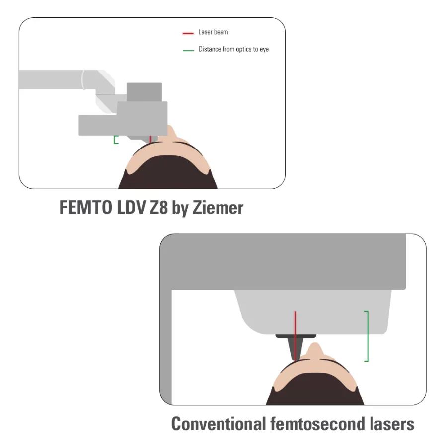 دستگاه فمتولیزر Femto LDV Z8